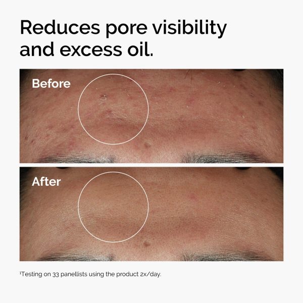 The Ordinary Skin Brightening Niacinamide 10% + Zinc 1% Serum 30ml