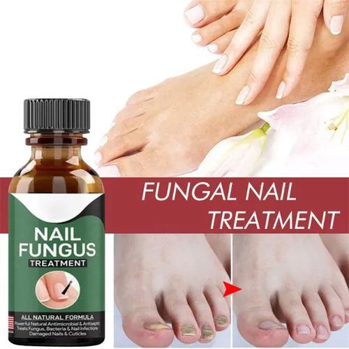 Fast Nail Fungal Treatments Nail Repair Essence Serum Care Treatments Foot Nail Fungus Removal Gel